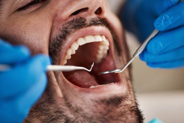 Best Mobile Emergency Dentist in Cedar Hill, TX